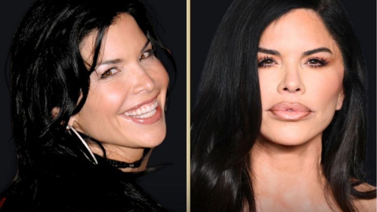 lauren sanchez plastic surgery lauren sanchez plastic surgery