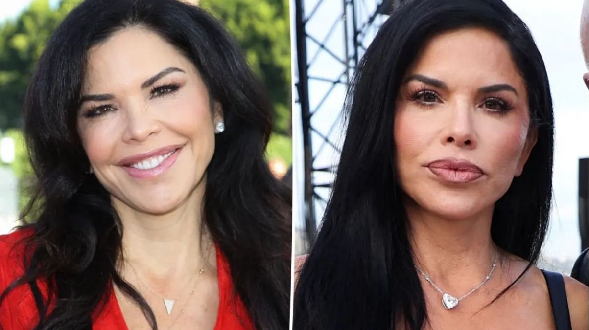 lauren sanchez plastic surgery lauren sanchez plastic surgery